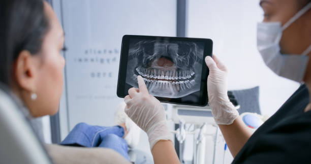 Licensed Tooth Extraction service in Berkeley County County, SC - Smile Center Dentistry